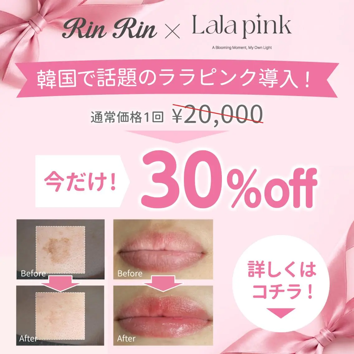 ララピンクの写真