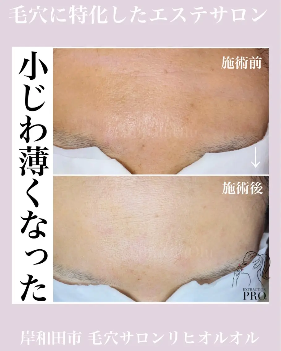 毛穴汚れ改善専門店/ 岸和田/リヒオルオルのエステ・リラクイメージ