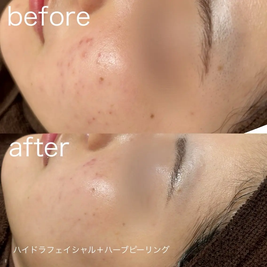 脱毛 lulularico Yuのネイルデザイン