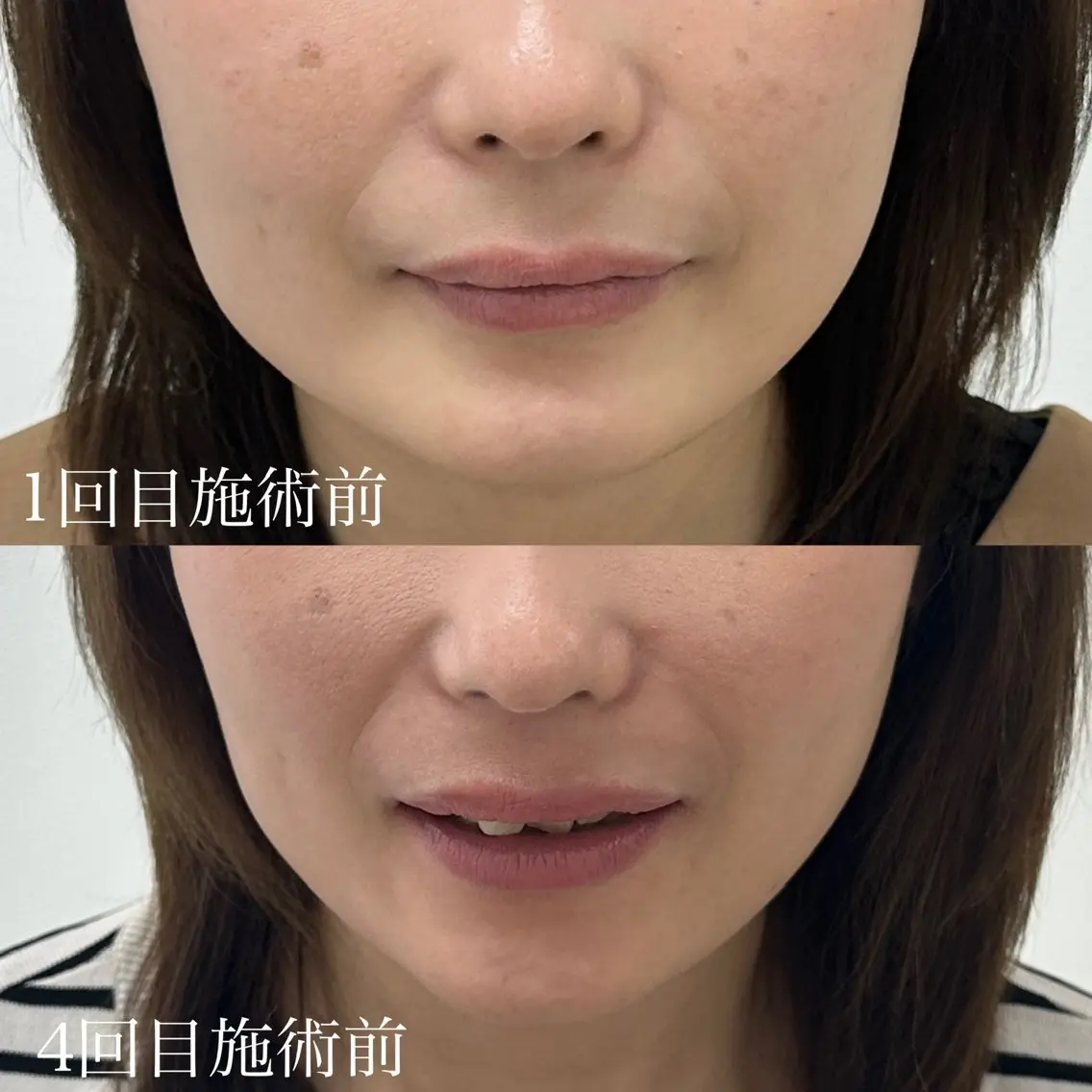 relle (リル)のネイルデザイン