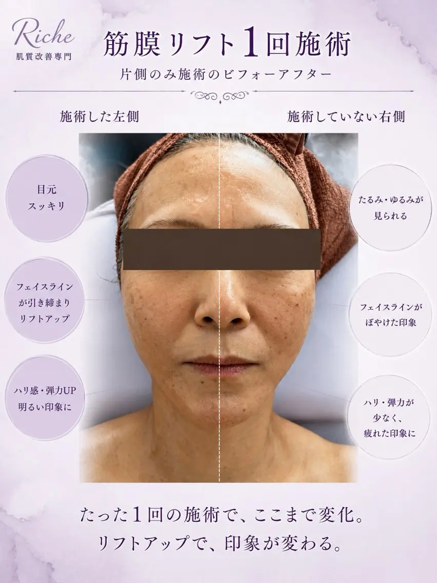 エステ 中摩 美命のエステ・リラクイメージ