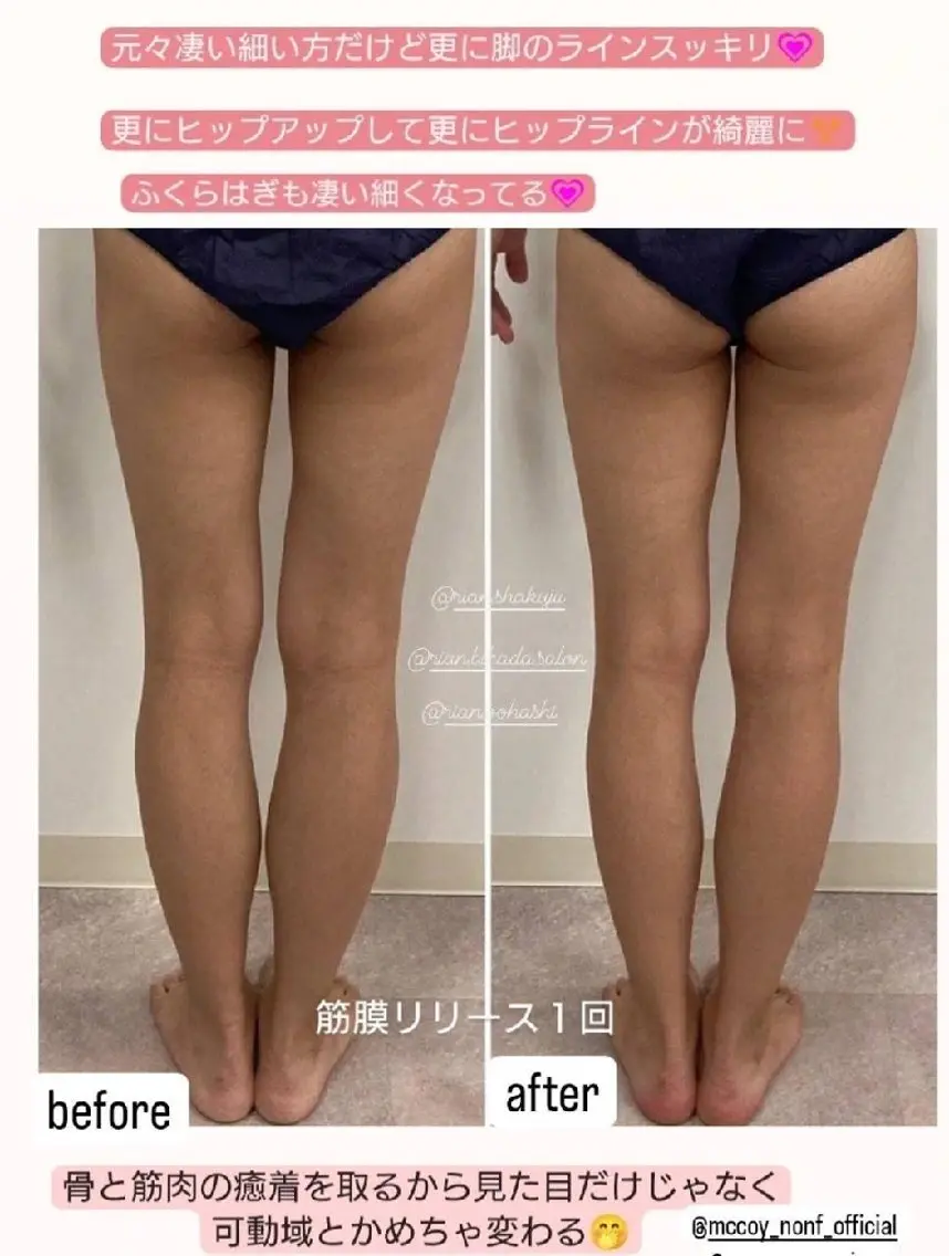 筋膜リリース120分の写真