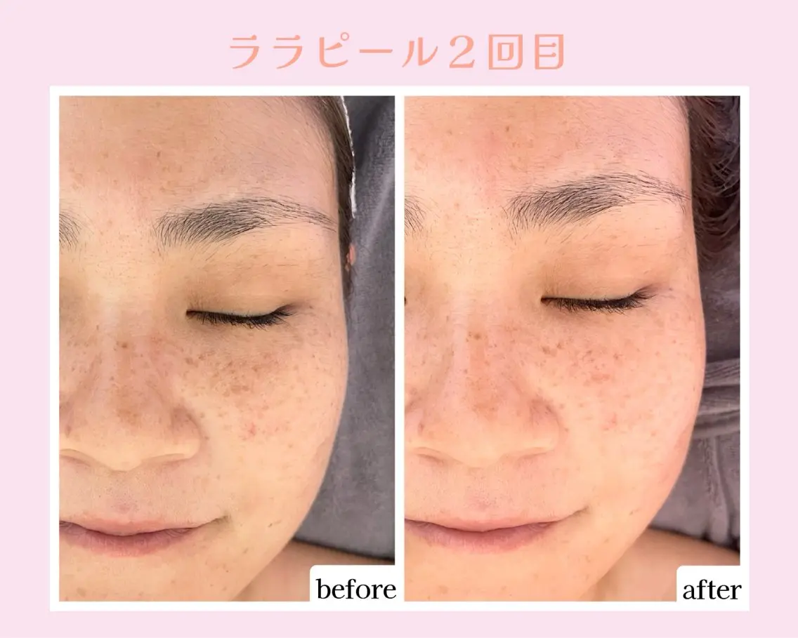 💜Karen PrivateSpaのエステ・リラクイメージ