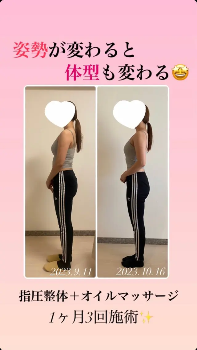 エステ リラク 《美肌･小顔》美容鍼 ＆マッサージ＊MEIのエステ・リラクイメージ