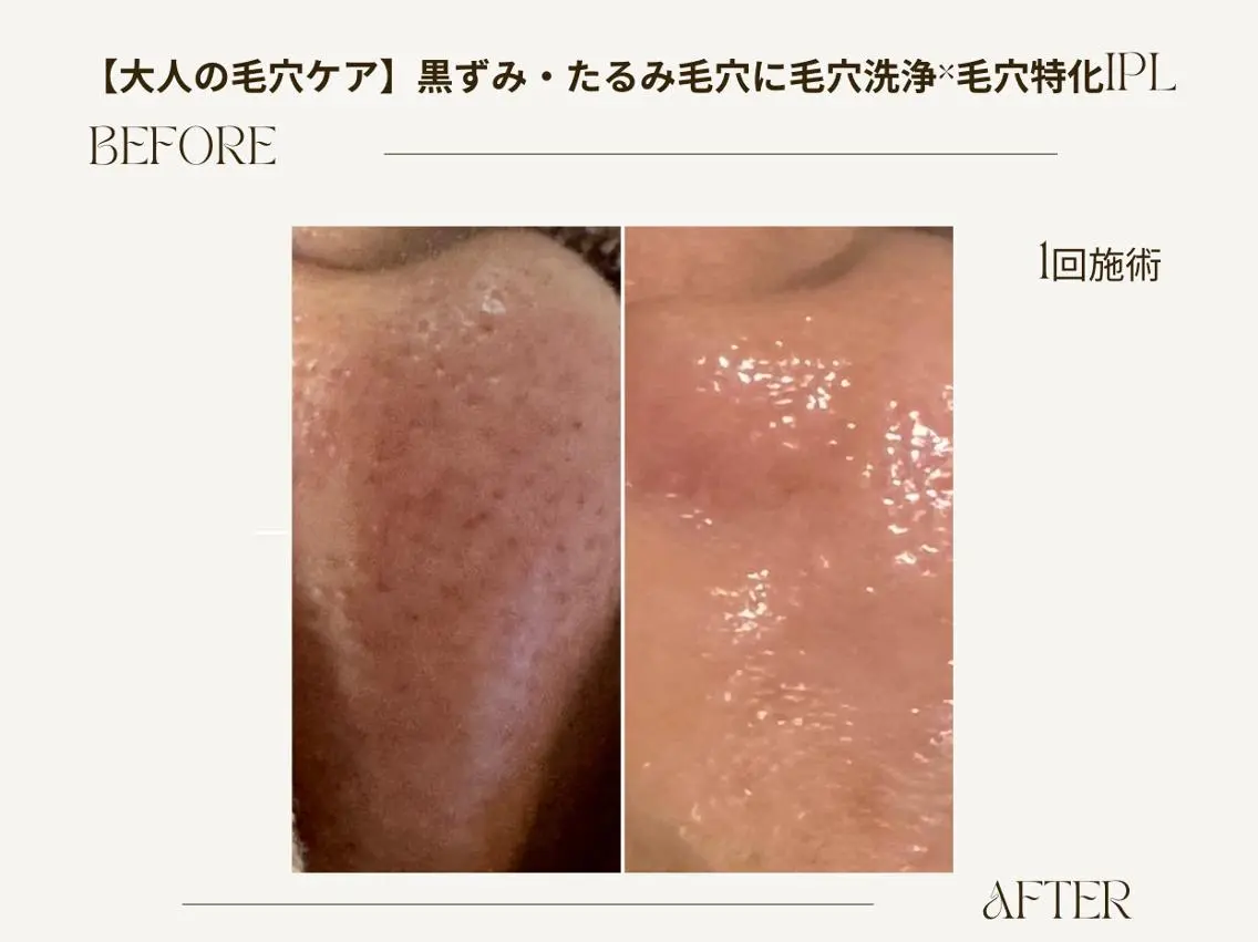 エステ ReCell 肌管理のエステ・リラクイメージ
