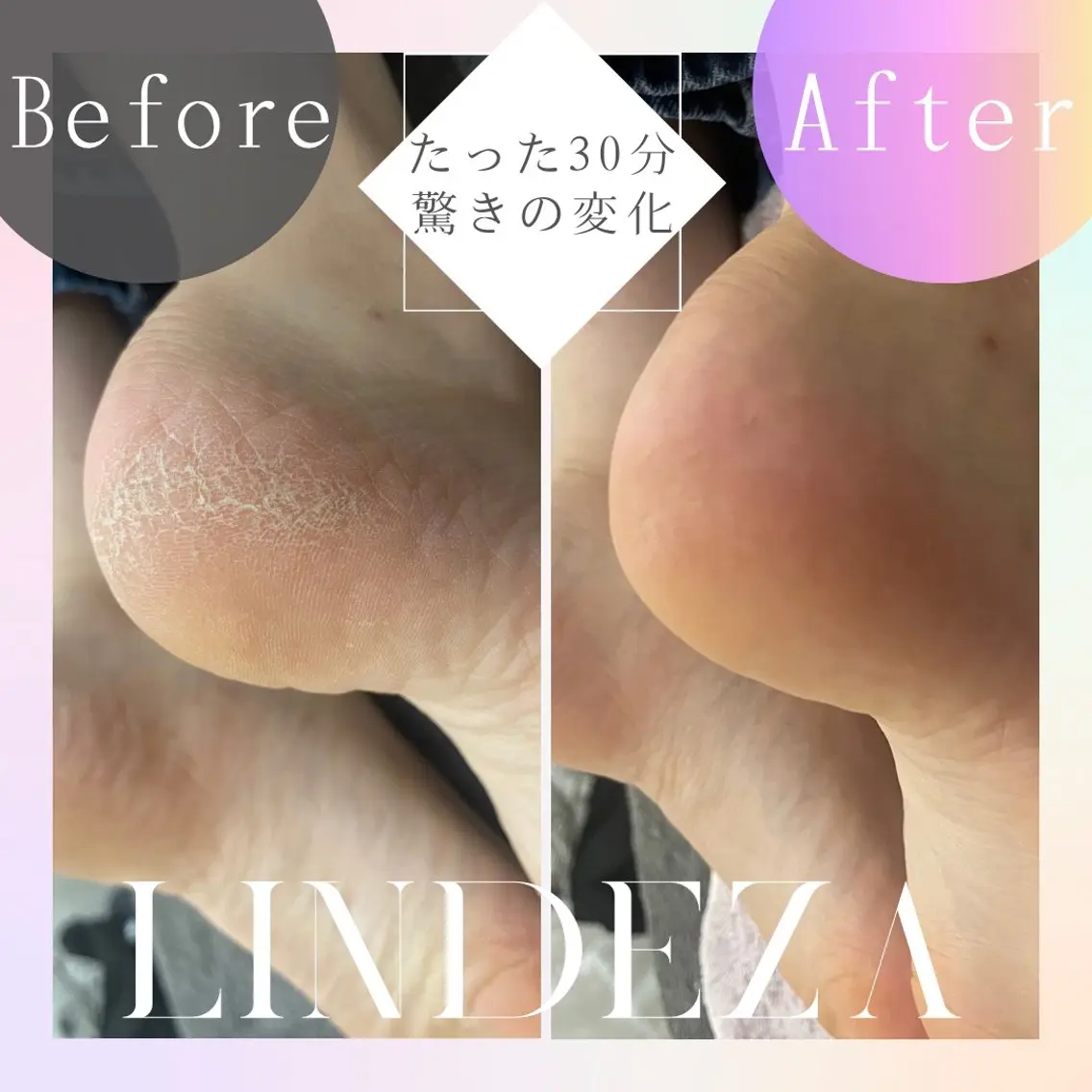 かかとケア＋足裏マッサージの写真