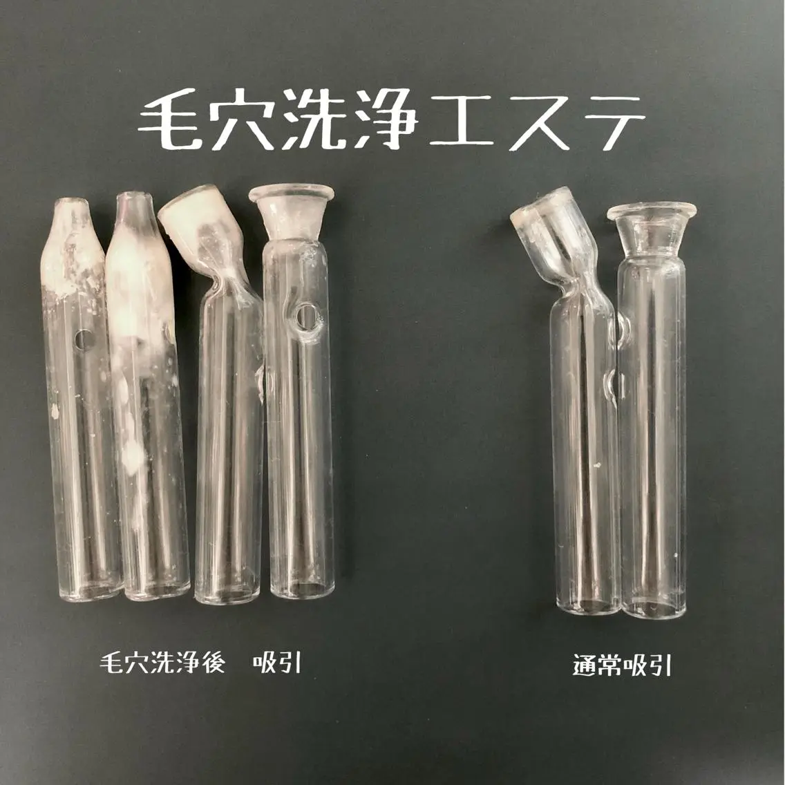毛穴洗浄エステの写真