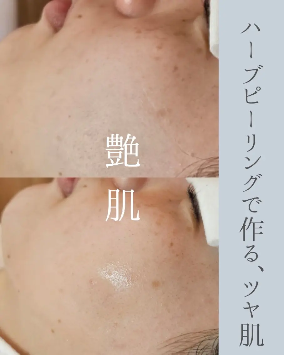 毛穴ハーブピーリング gypsophiraのエステ・リラクイメージ