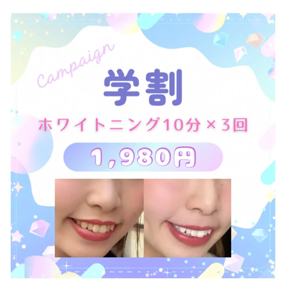 🍎学生限定🍎セルフホワイトニング初回体験10分×3回✨口元のメイク映えにも🙆♀️メンズにも大人気🙆♂️の写真