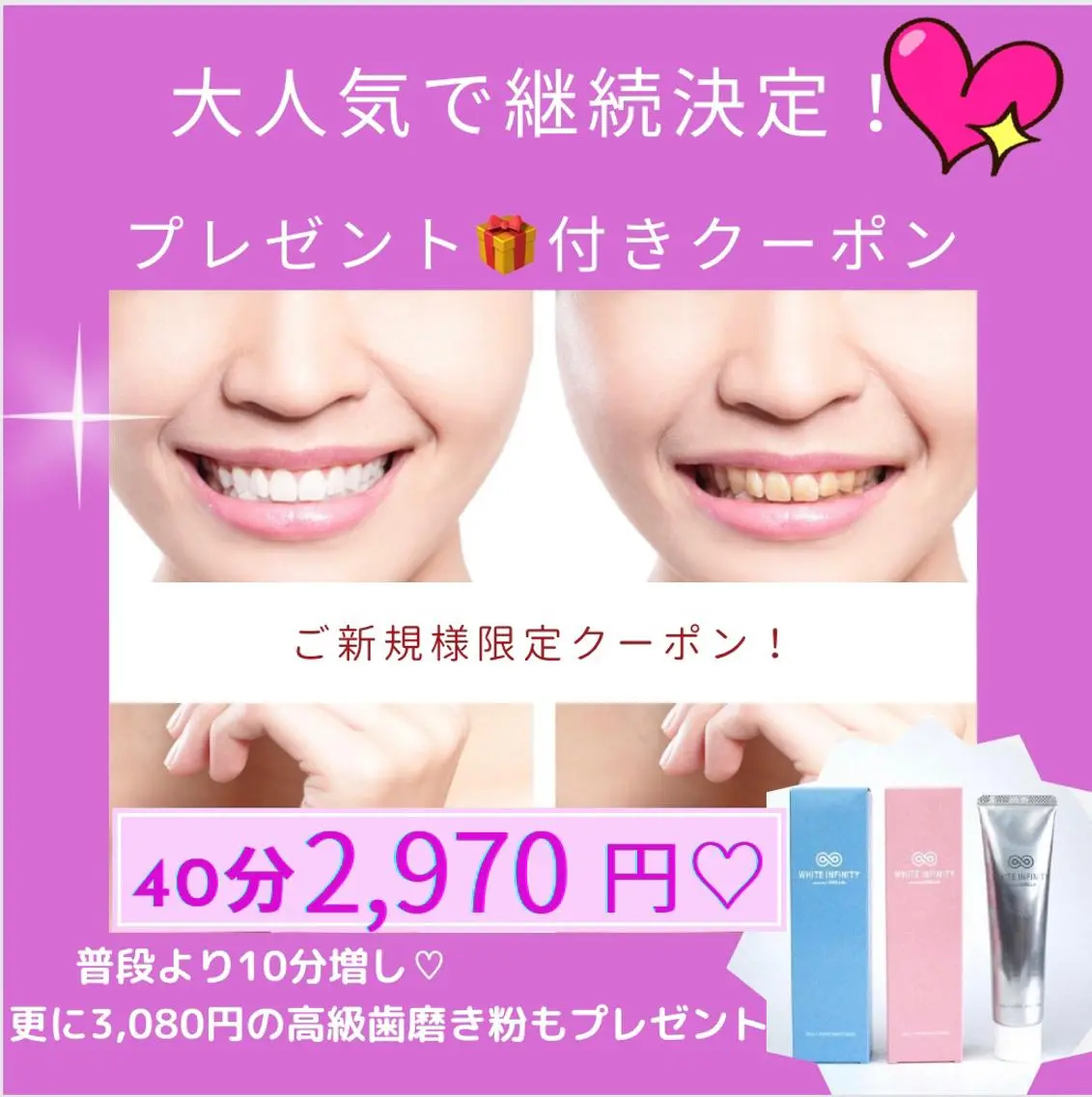 大人気で継続決定プレゼント付きクーポン🧧30分➕10分のトータル合計40分照射に、高級歯磨き粉まで帰りにもらえちゃう♪の写真