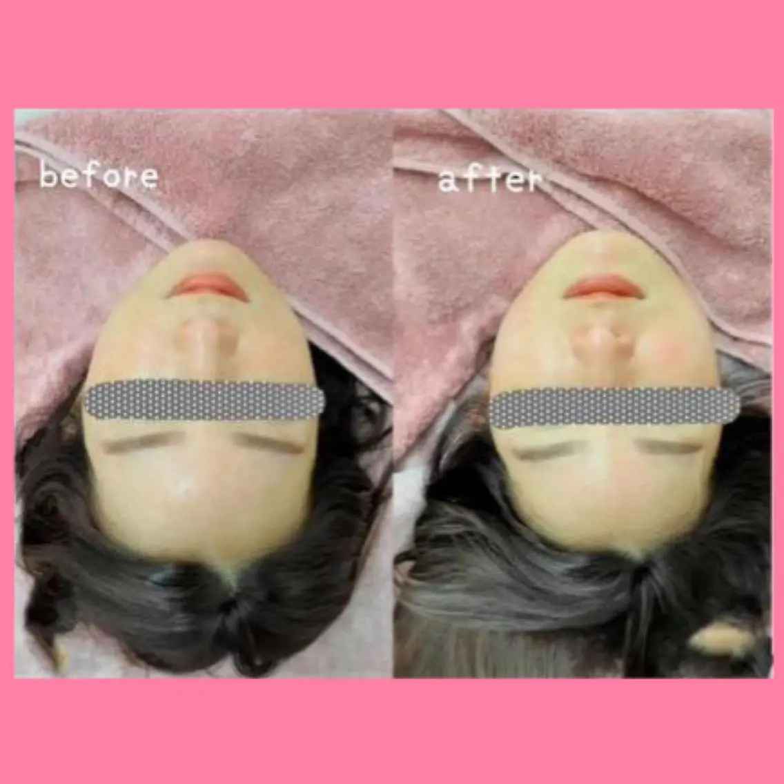 肌ケア＆毛穴洗浄 Cheri/女性専用のエステ・リラクイメージ