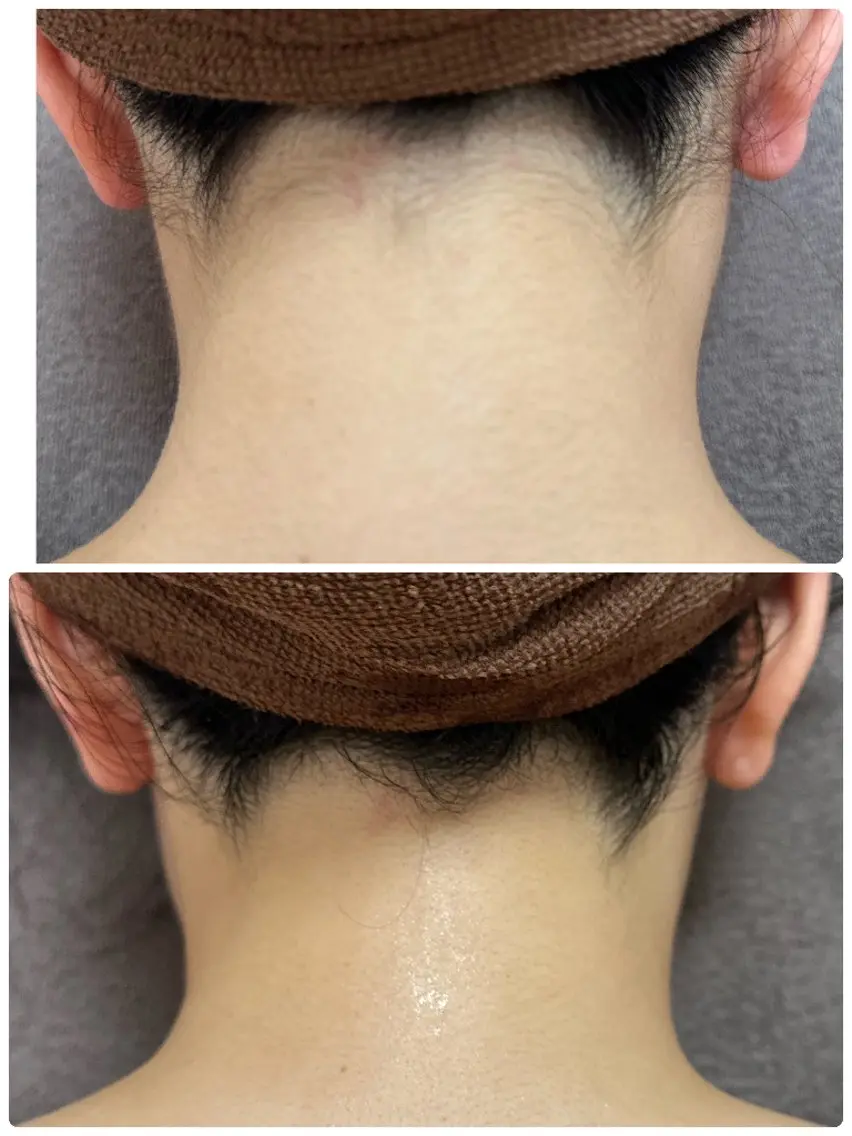 その他 看護師 桐山 まどかのエステ・リラクイメージ