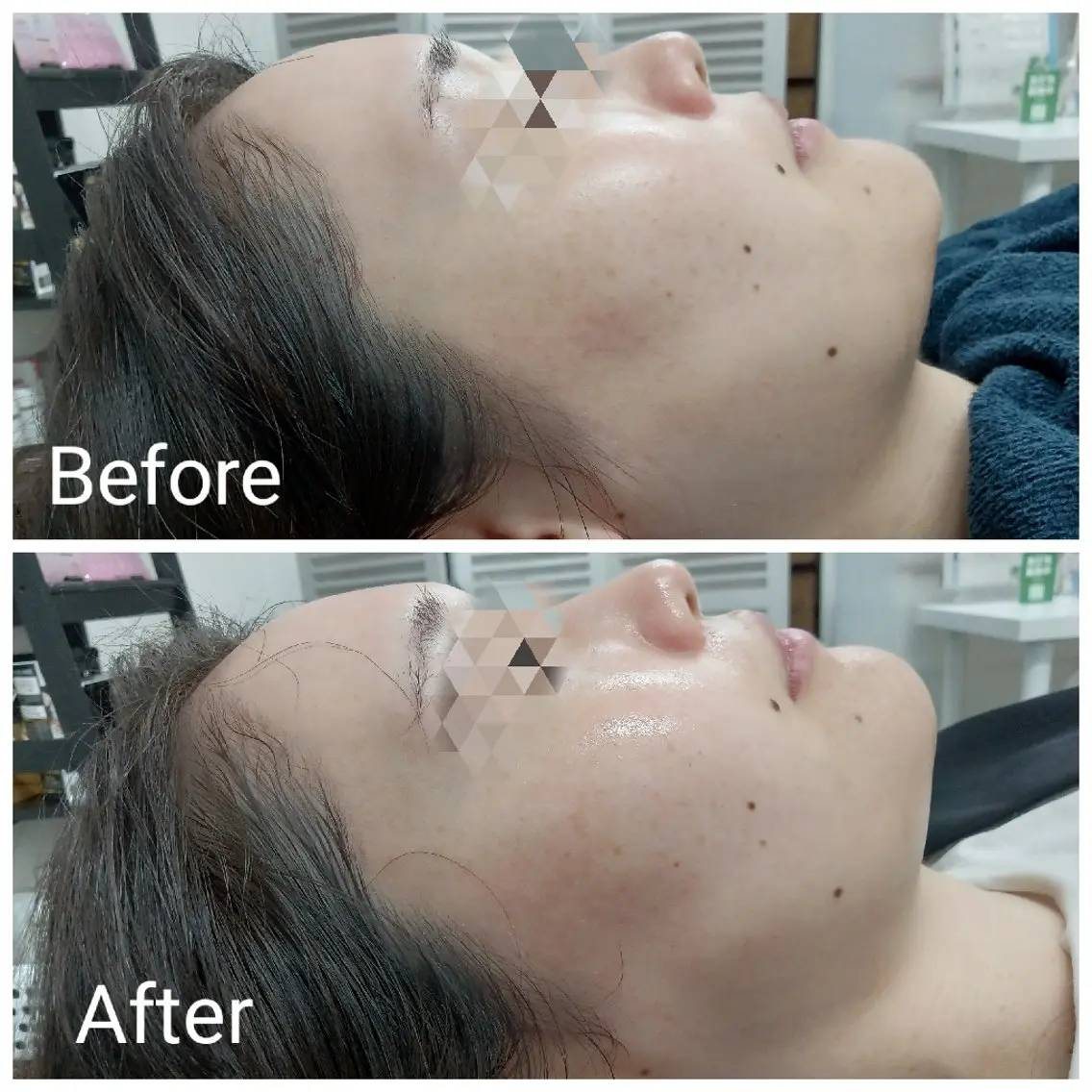 エステ リラク 肌質改善Beauty salon Renのエステ・リラクイメージ