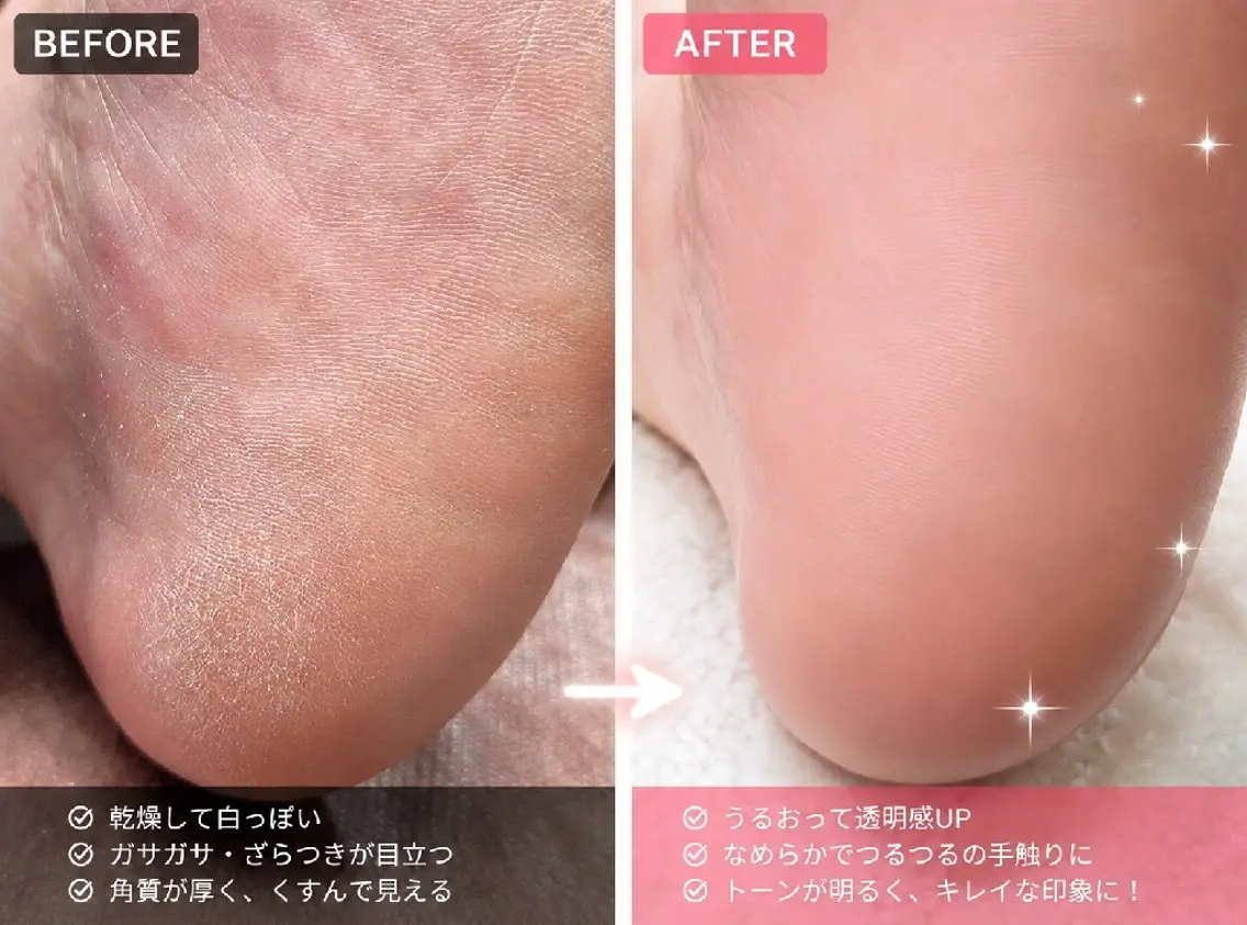 その他(ネイル) ネイル&巻き爪サロン AKnailのネイルデザイン