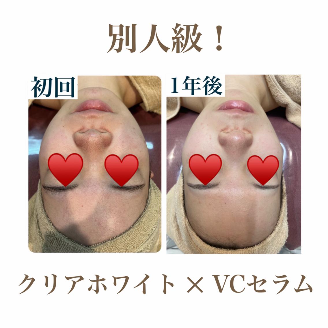 エステ 🫧美肌サロン🫧 レイビスひかる🧡のエステ・リラクイメージ