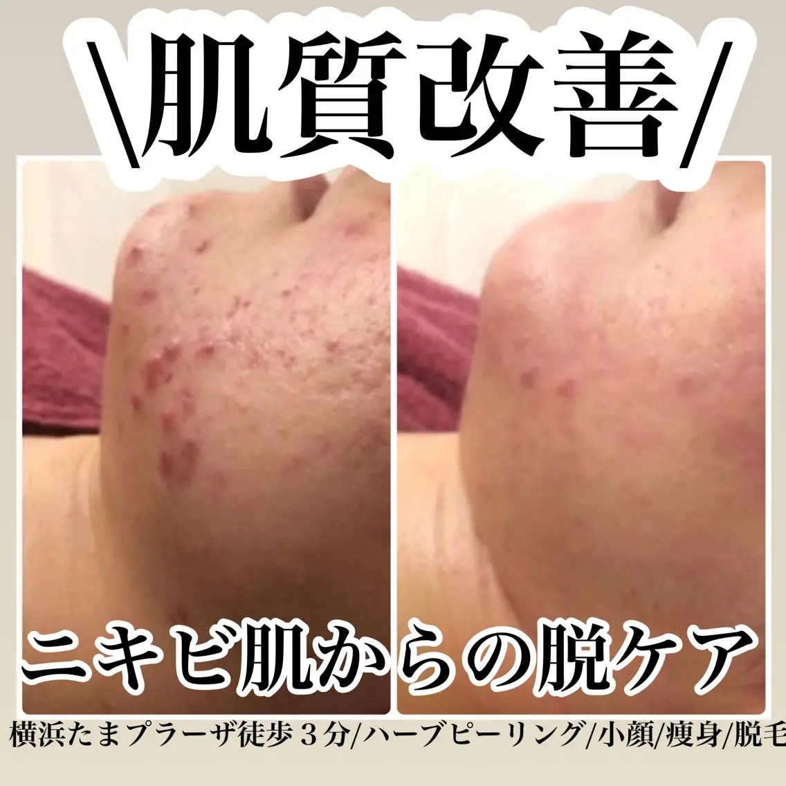 LILIANA ☆YURIのエステ・リラクイメージ