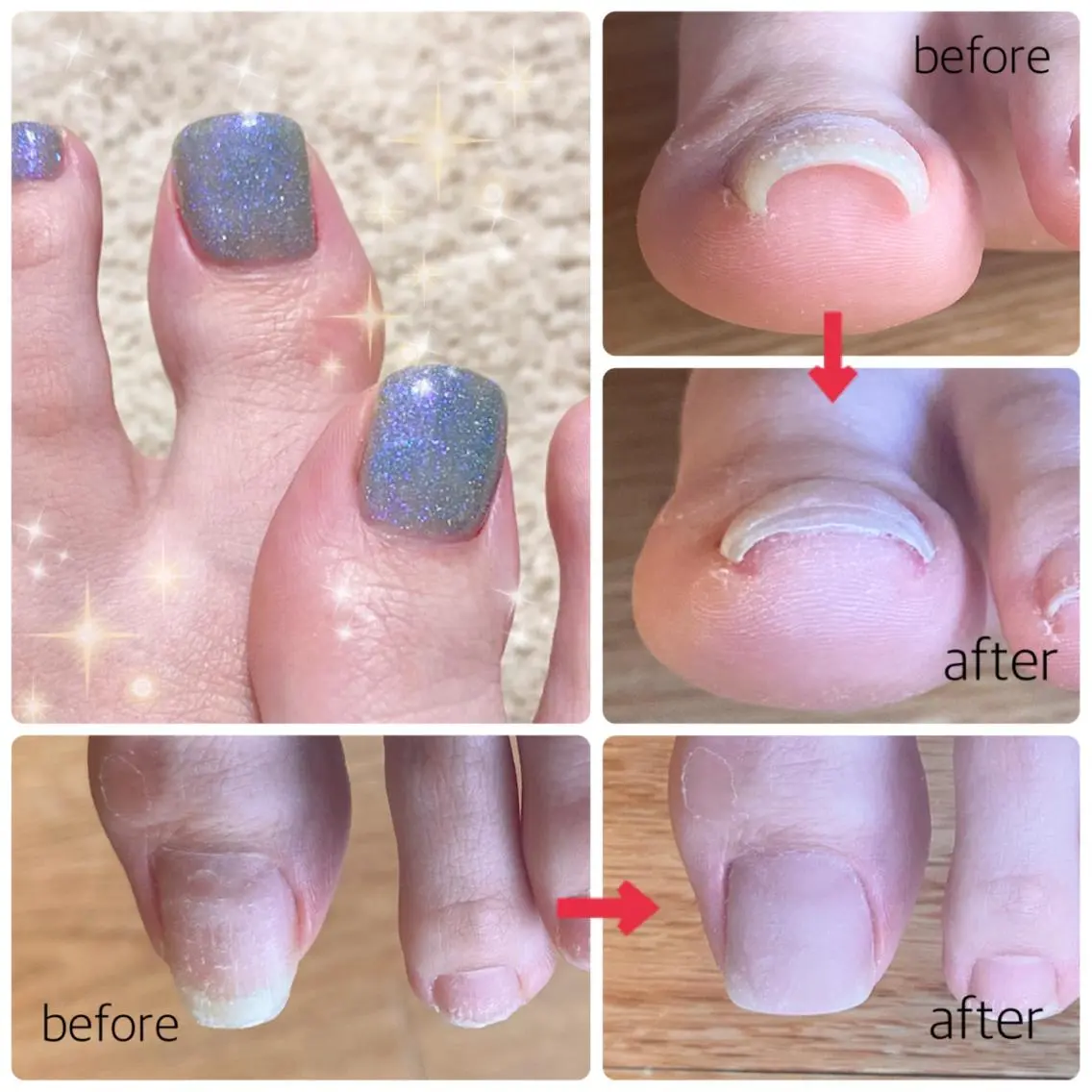 ネイル ジェルネイル フットネイル C's nailのネイルデザイン