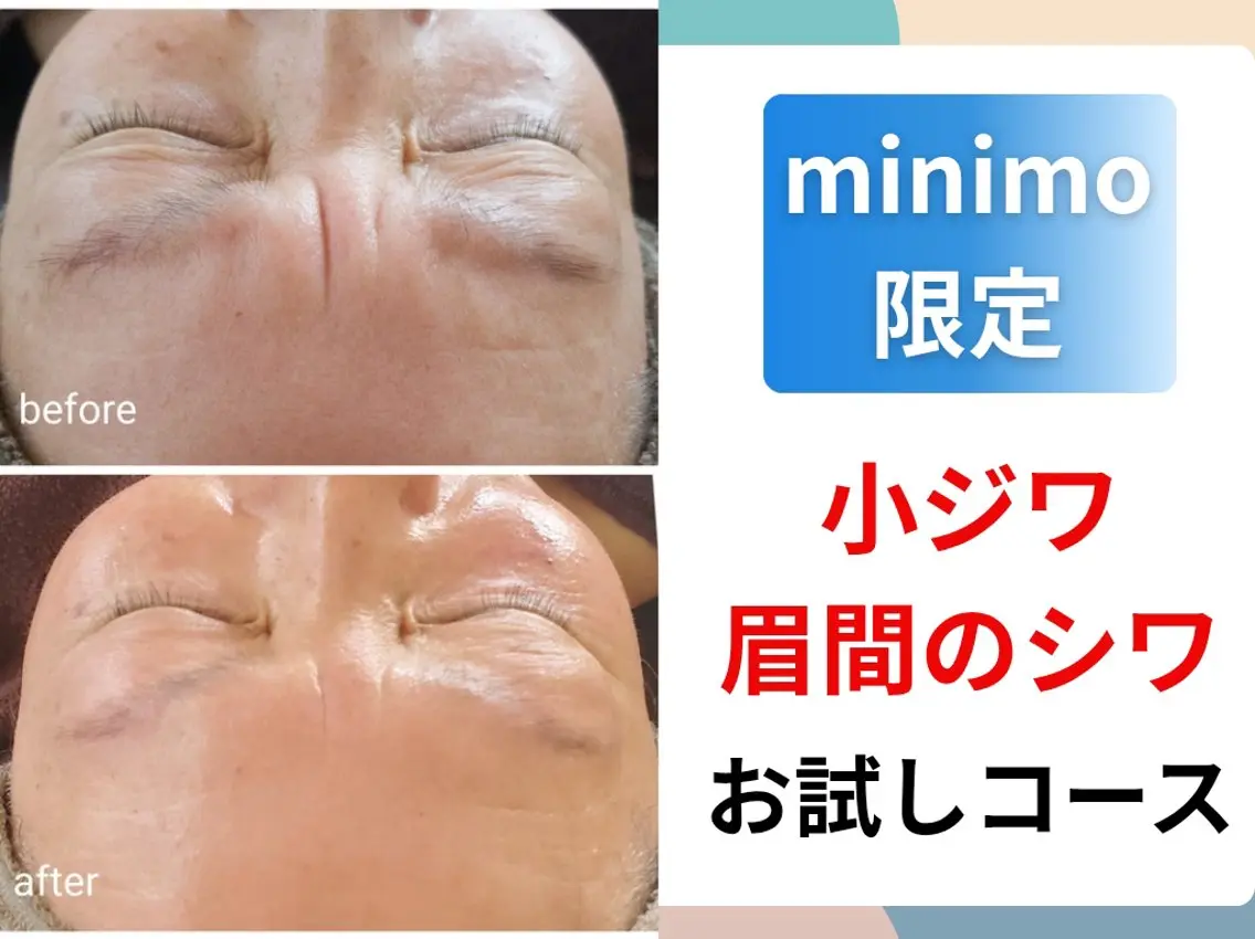 エステ 肌悩み解決サロン ハーブピーリングのエステ・リラクイメージ