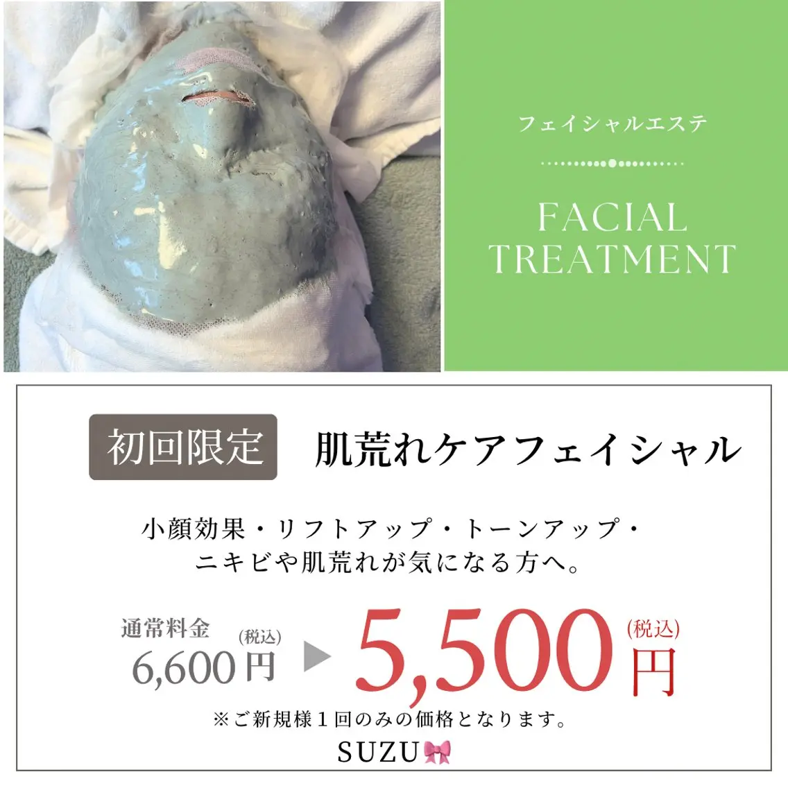 肌荒れケアフェイシャル(ニキビ)の写真