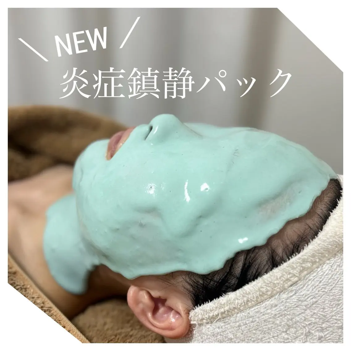 繰り返す肌荒れ鎮静、揺るがないお肌作り🌿アドバンスコース50分【イルネージュ使用】+炎症鎮静パック(20分)の写真