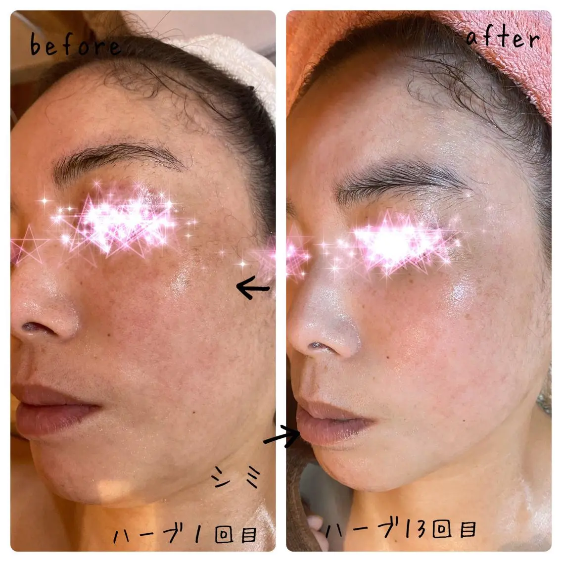 fairyrose organicエステのエステ・リラクイメージ
