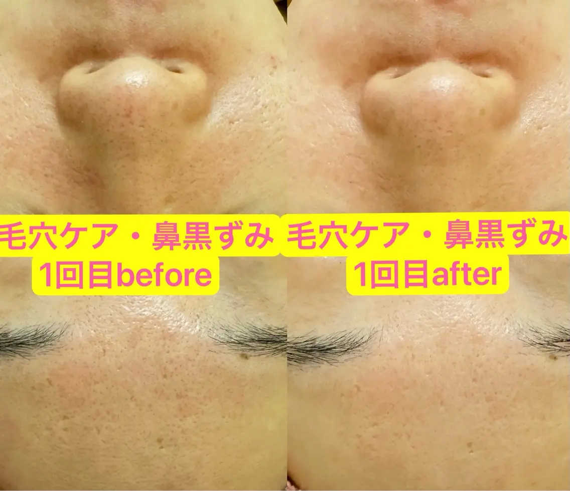 🎀エレガンテ🎀 美肌専門👸本間のその他イメージ