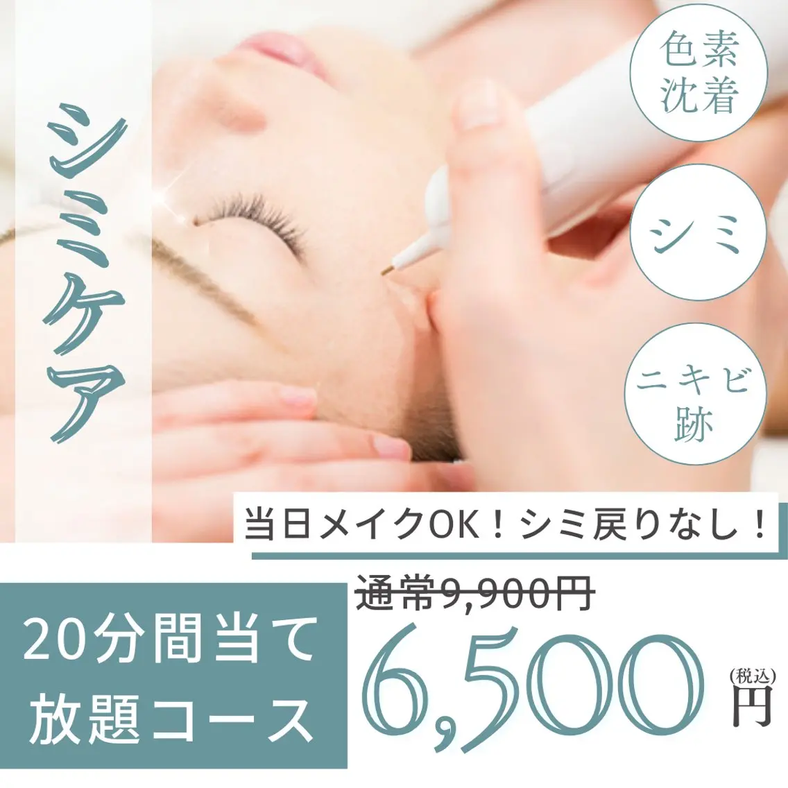 ✨シミ取り放題20分✨《シミケアコース》お肌に優しい低周波シミ取りで1週間で薄いシミも濃いシミもポロっと剥離◎の写真
