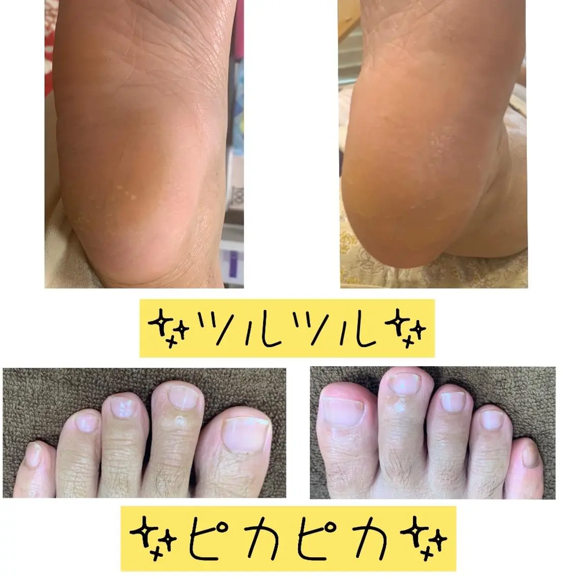 フットケア　素足べっぴんさんフルコースあなたのお足をツルツル✨ピカピカ✨にオイルリフレでしっかり保湿♫癒やされてくださいの写真