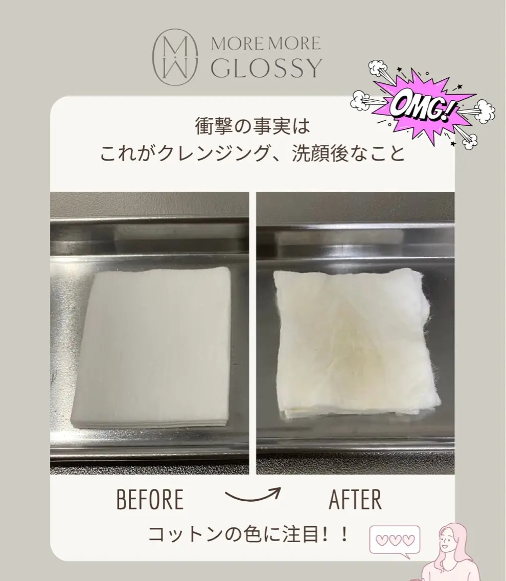 夏のくすみ肌に☀️クィックピーリング✖️眠れる美女コルギ 70分/お肌もお顔もリセットして、夏を楽しもう🌴💆の写真
