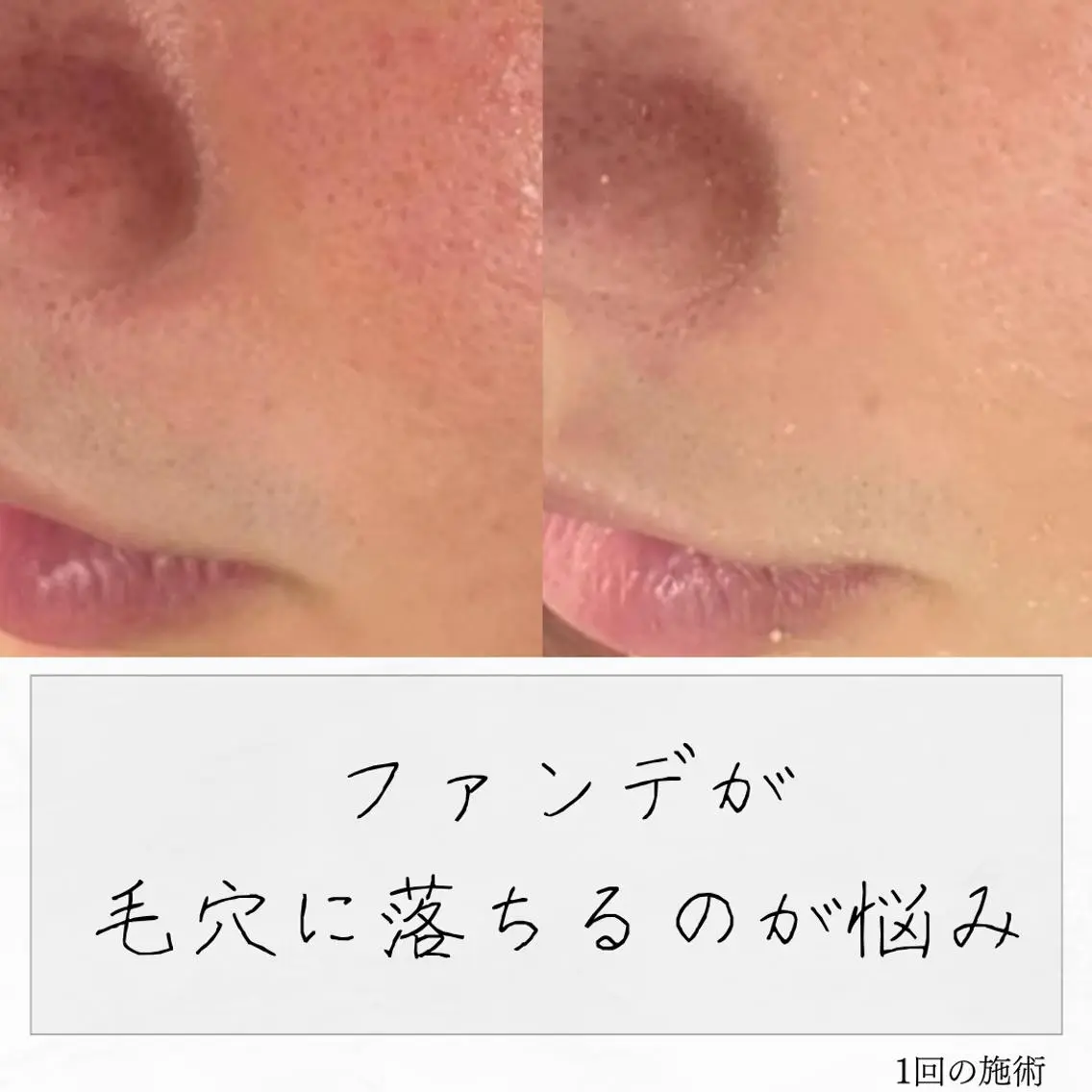 ニキビ経験者が施術 する専門サロン🌻のエステ・リラクイメージ