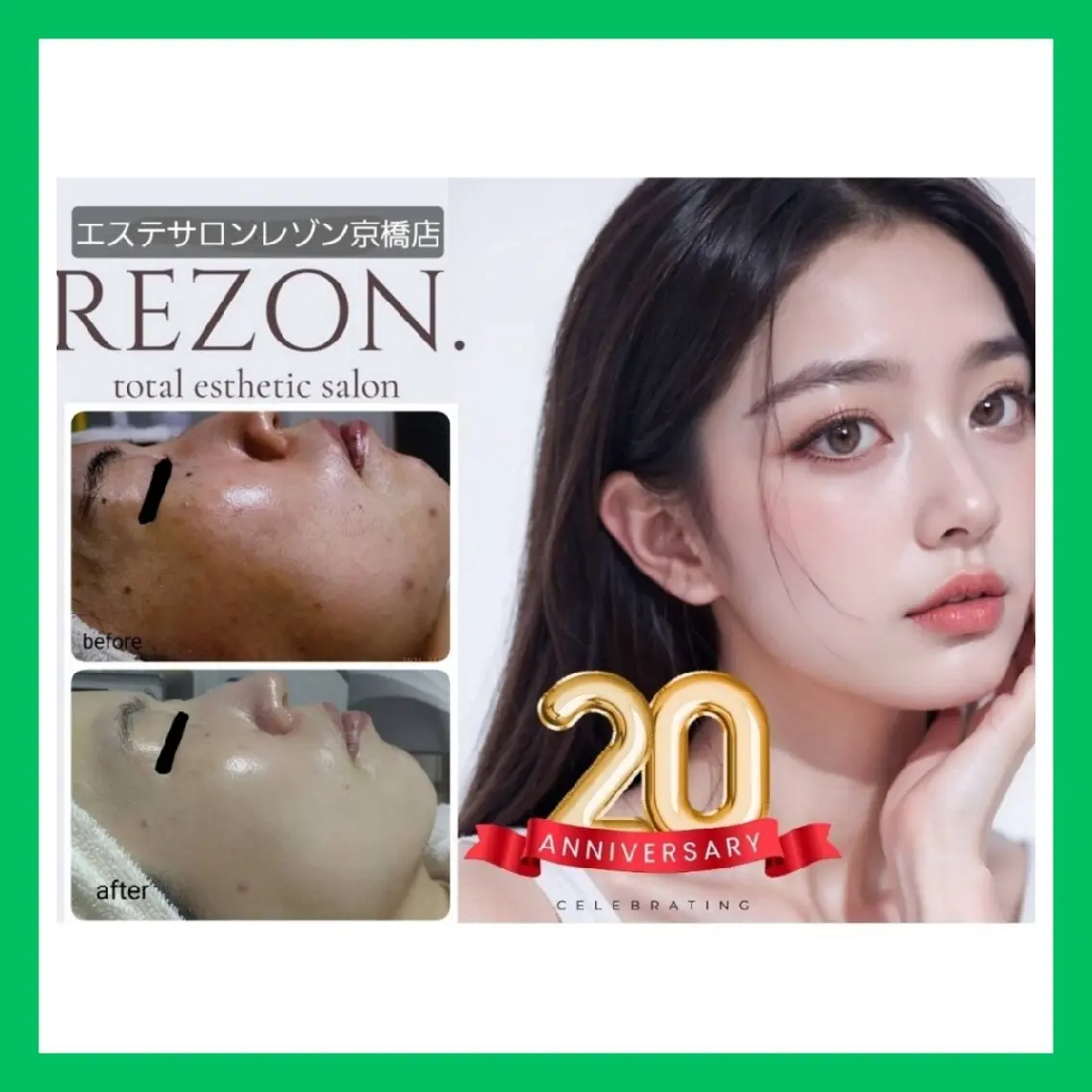💎社会人応援割💎《本気のニキビ・ニキビ跡ケア！》ニキビケア2回体験✨　[大阪城北詰駅/京橋駅]の写真