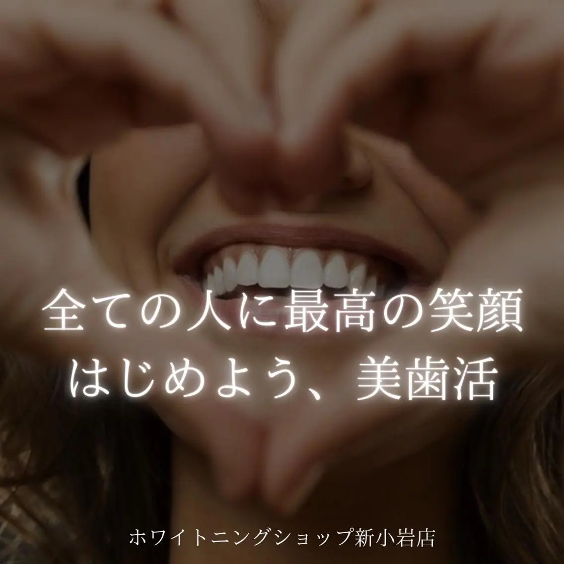 メンズ その他 ホワイトニング ショップ新小岩店のその他イメージ