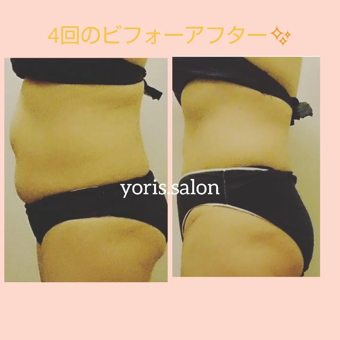 【ボディ】燃焼★メルティ&バーニング ボディコース 120分の写真
