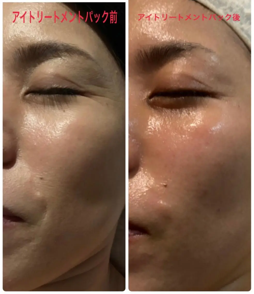アイトリートメント付きスタンダードコースの写真