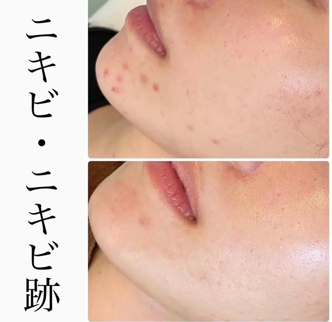 ハーブピーリング専門 BIOPLUS+川崎のエステ・リラクイメージ