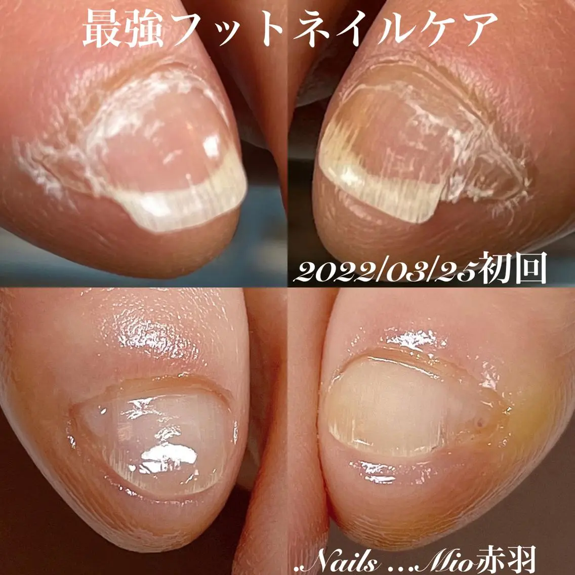 ネイル フットネイル .Nails Mio 赤羽西ネイルサロンのネイルデザイン