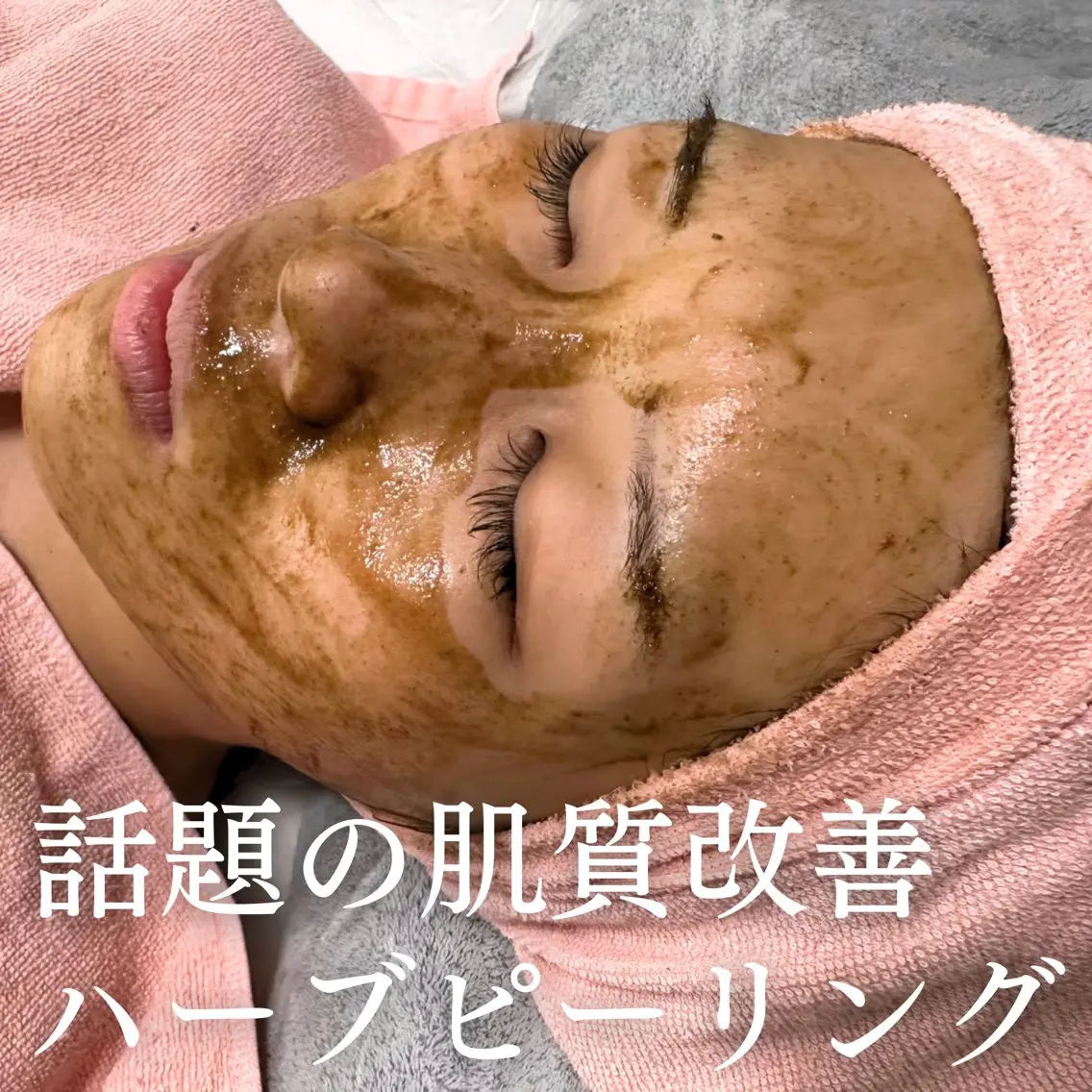 エステ BestBelleꕤ 大阪福島/肌質改善のエステ・リラクイメージ