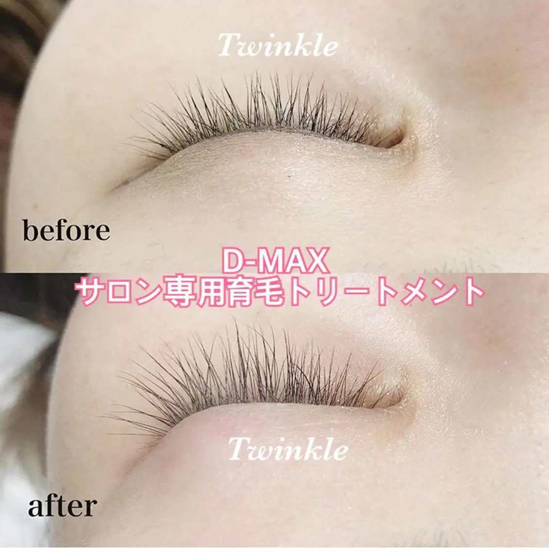 マツエク・マツパ えみり 【Twinkle 】のマツエク・マツパデザイン