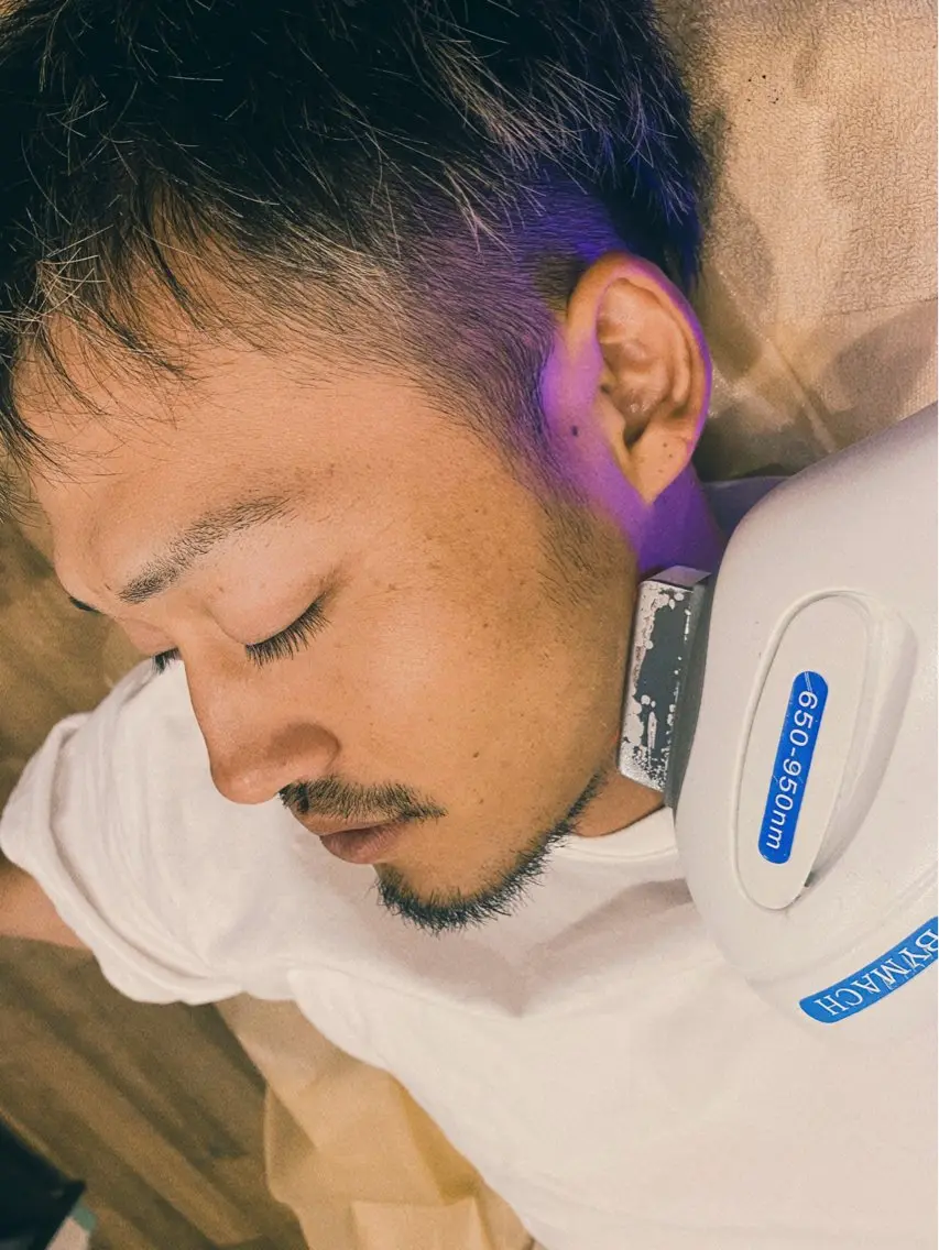 ひげ脱毛の写真