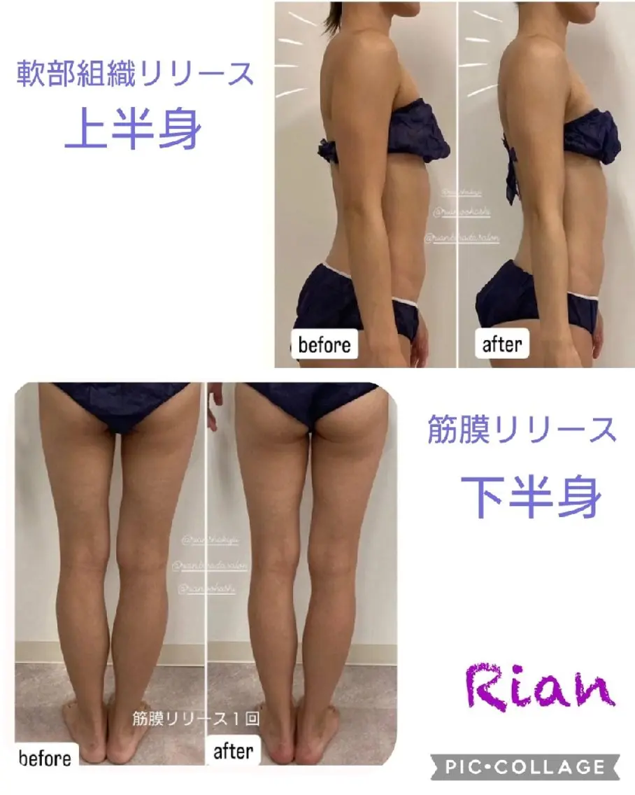 その他 肌質改善&筋膜エステ Rian 福岡市南区のエステ・リラクイメージ