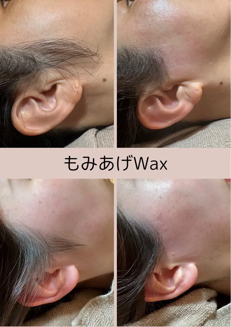 脱毛サロン Arumのエステ・リラクイメージ