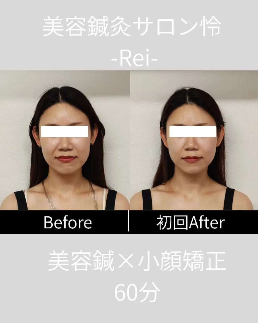 美容鍼灸サロン怜 -Rei-のエステ・リラクイメージ