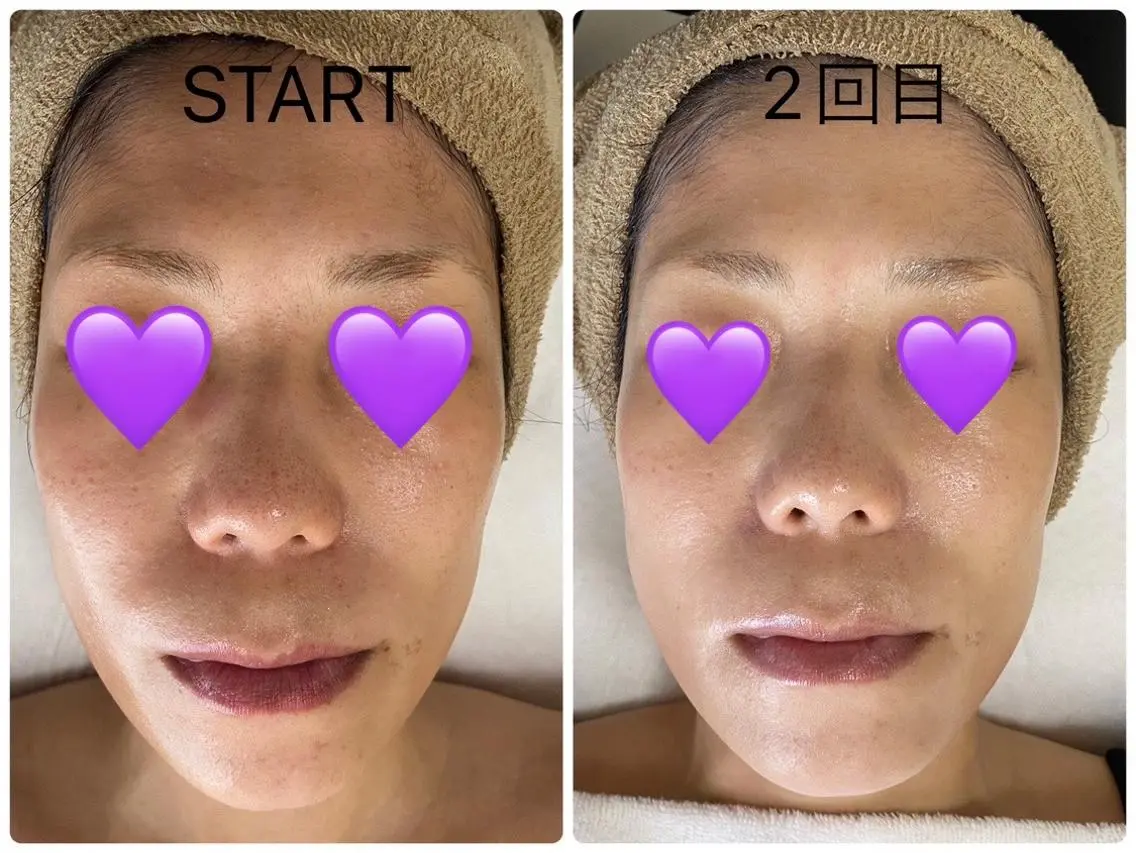 COCO beautyサロンのエステ・リラクイメージ