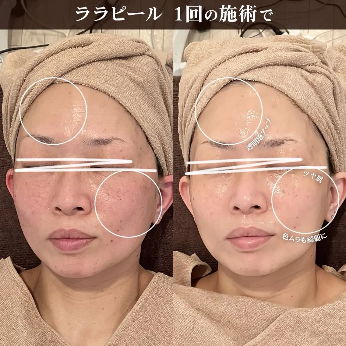 エステ トータルビューティー サロンキノセ折井のエステ・リラクイメージ