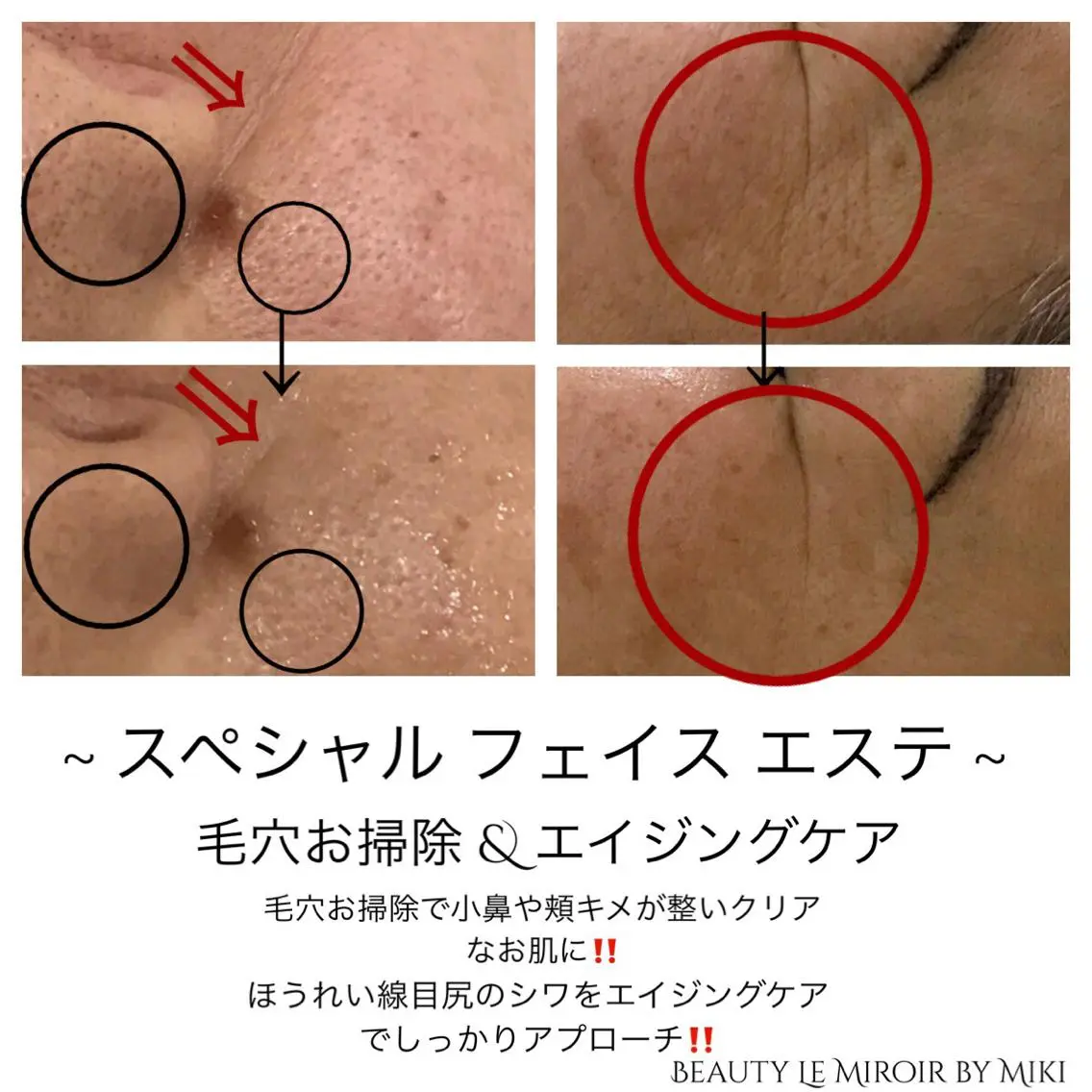 ビューティー ミロワールのエステ・リラクイメージ