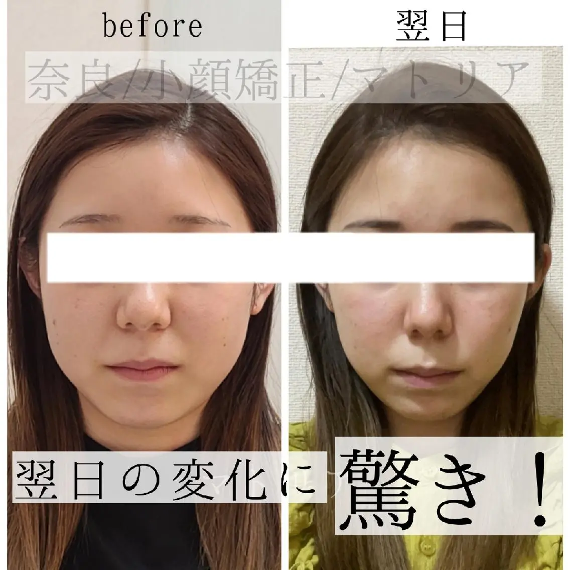 エステ 小顔 美肌専門 Matoriaのエステ・リラクイメージ