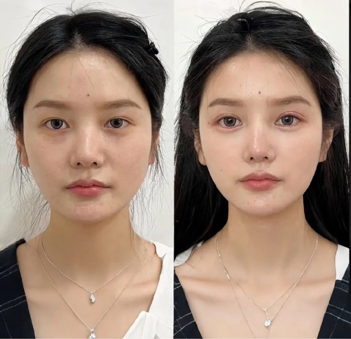マツエク・マツパ エステ リラク 愛維美水光美肌専門店 メンズレディースokのエステ・リラクイメージ