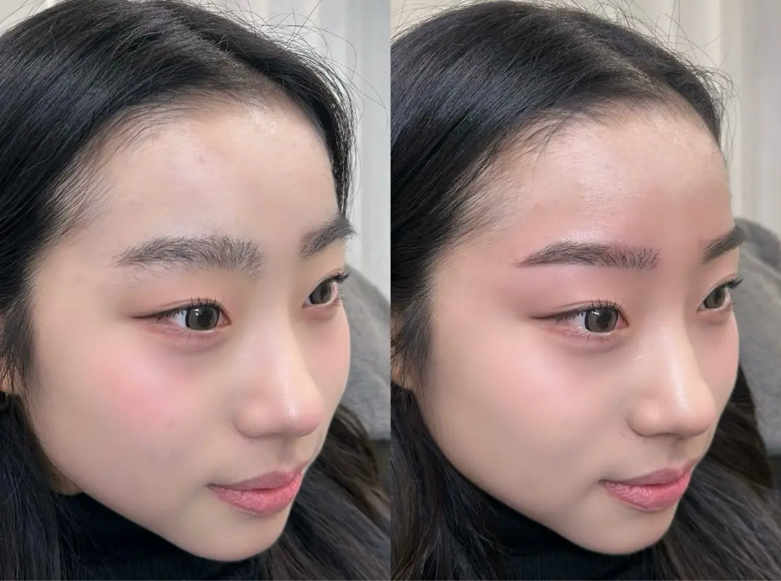アイブロウ ワックス脱毛 その他(アイブロウ) NEUBROW Aiの眉毛・アイブロウイメージ
