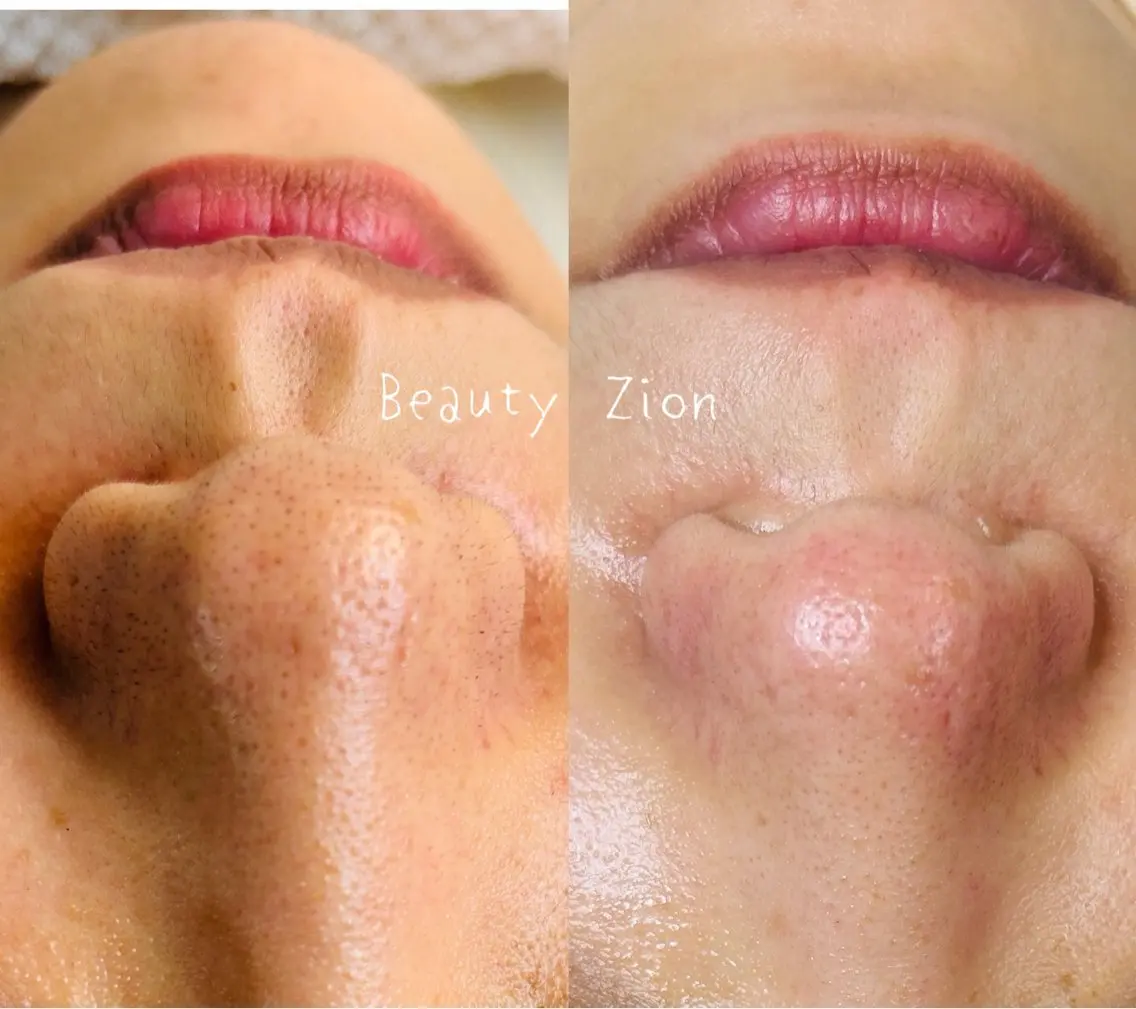 Beauty Zionのエステ・リラクイメージ