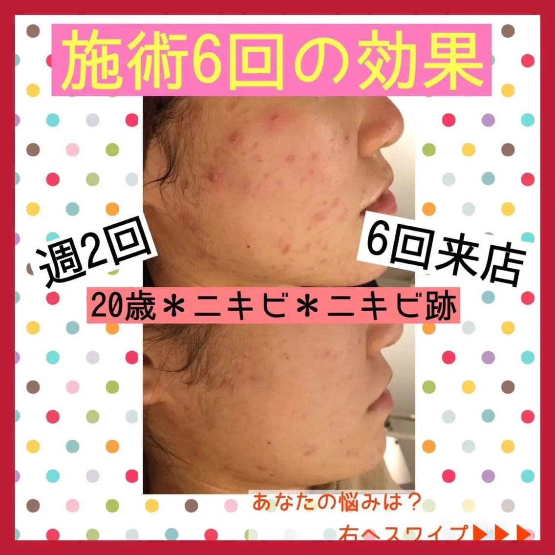 ミディアム カラー パーマ ヘアアレンジ メンズ キッズ ネイル マツエク・マツパ ニキビ・肌質改善専門 ♡人生が変わるサロンのエステ・リラクイメージ